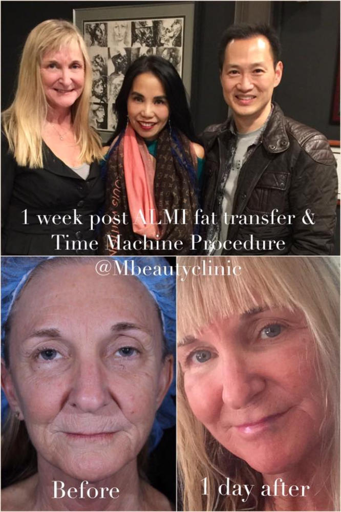 time machine glutathione M Beauty by Dr. Tess